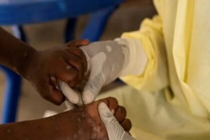 Gambia Confirms First Mpox Case, Declares National Outbreak
