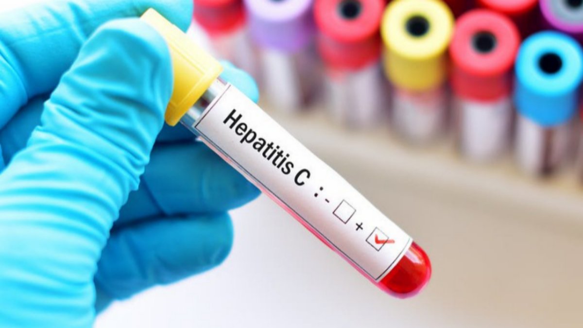 Hepatitis Costs Nigeria ₦17.9tn Yearly, FG Flags 'Project 365'