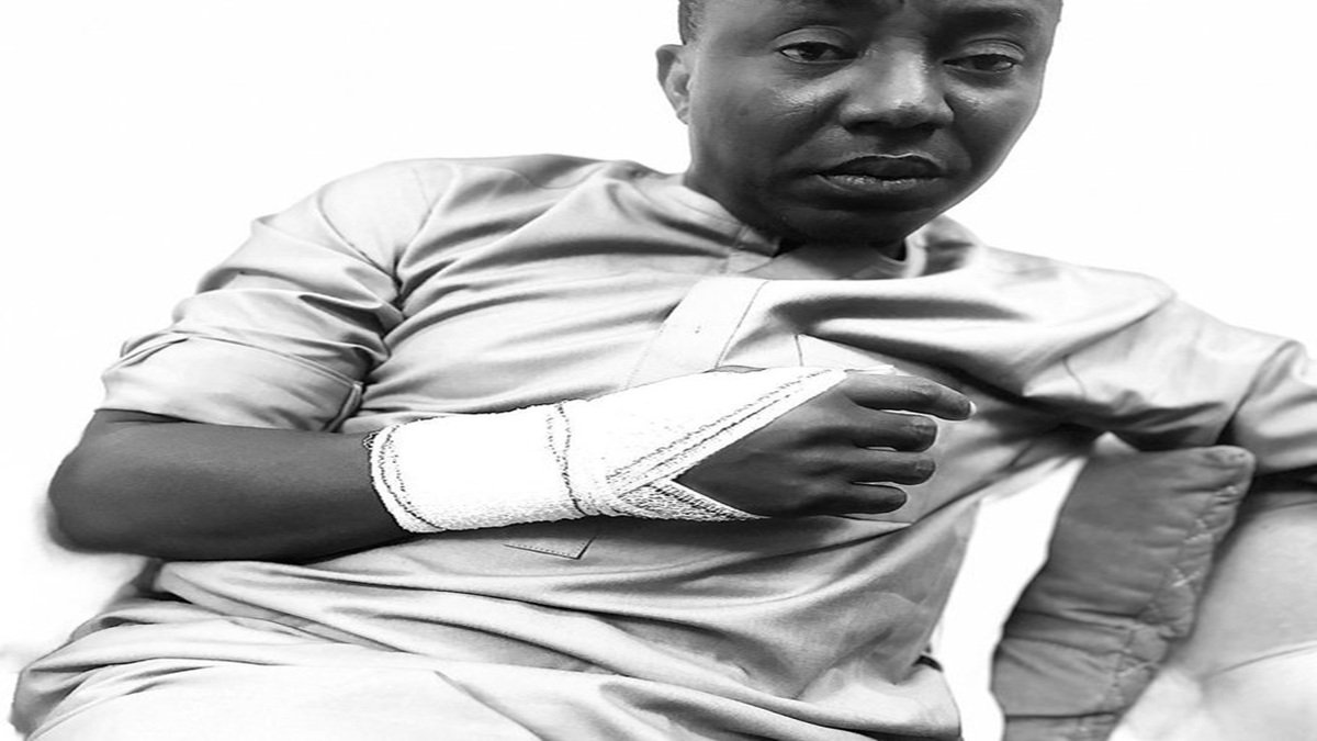 Omoyele Sowore Injured by Police in Abuja Amid #EgbetokunMustGo Protests