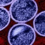 Ondo Confirms 12 M-pox Cases, Begins Vaccination