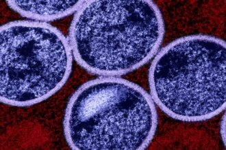Ondo Confirms 12 M-pox Cases, Begins Vaccination