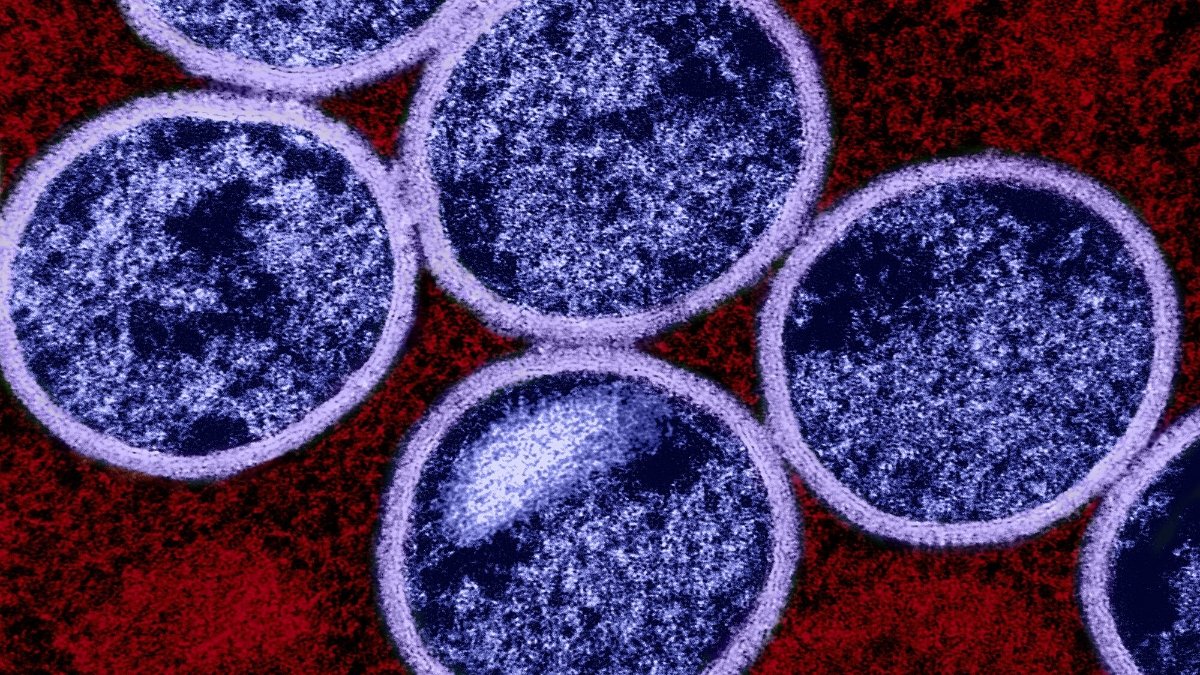 Ondo Confirms 12 M-pox Cases, Begins Vaccination