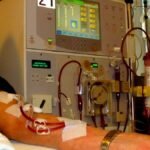 Tinubu Slashes Dialysis Fee Across Federal Hospitals