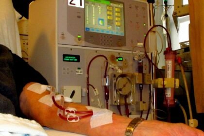 Tinubu Slashes Dialysis Fee Across Federal Hospitals