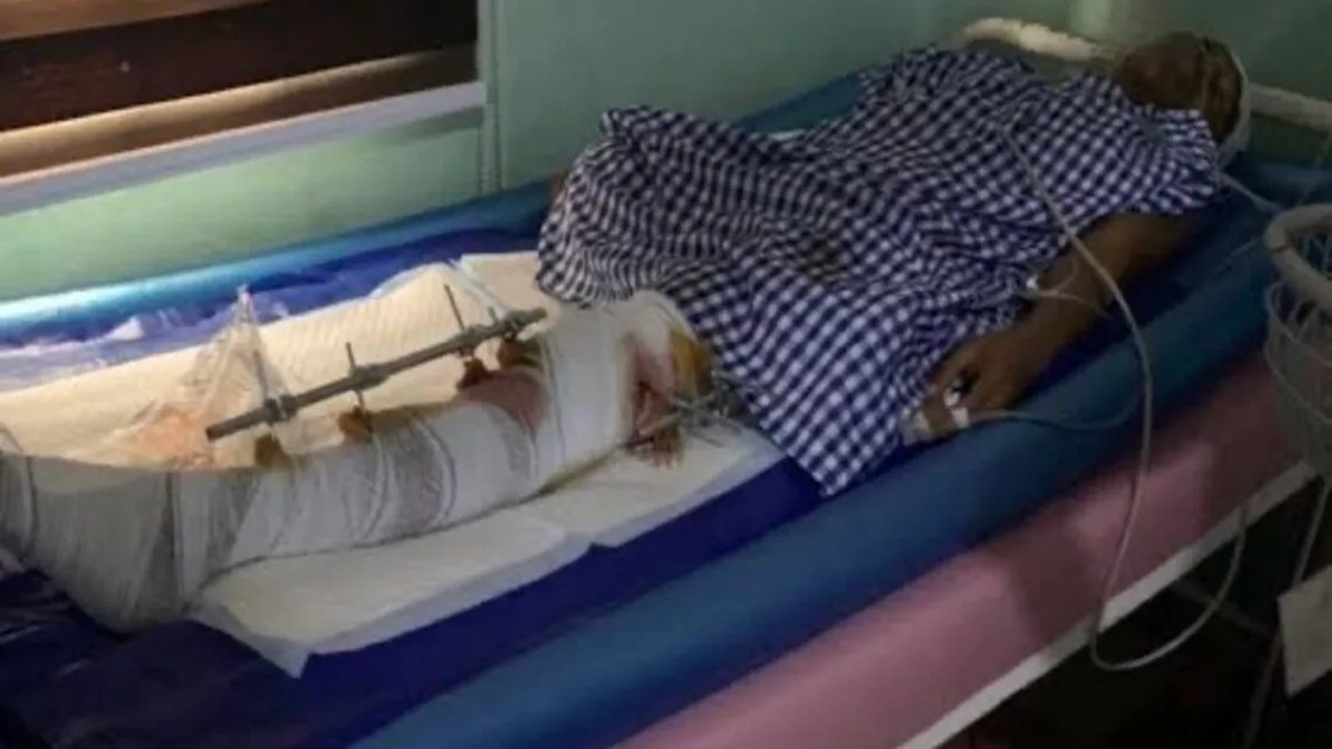 Dangote Group Pledges Medical Support for BBNaija Phyna’s Sister After Edo Truck Accident